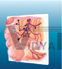 The dissection model of appendix and caecum